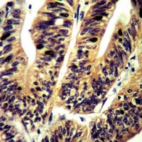 c-Met (Phospho-S985) Antibody