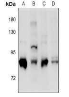 PKC delta (Phospho-S664) Antibody