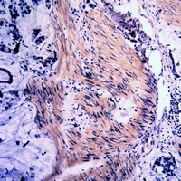 Anti-Vimentin (Phospho-S39) Antibody