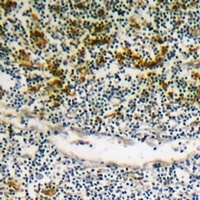 Anti-BIK (Phospho-S35) Antibody
