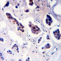 Cyclin D1 (Phospho-T288) Antibody