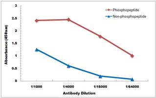 Anti-DSCR1 (Phospho-S108) Antibody