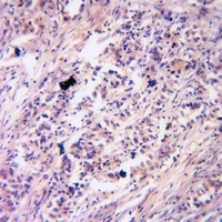 Anti-PKC gamma (Phospho-T514) Antibody