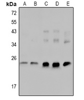 cTnI (Phospho-S23/S24) Antibody