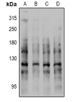 E Cadherin (Phospho-S844) Antibody