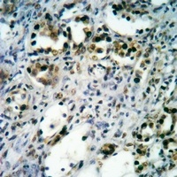 BTK antibody