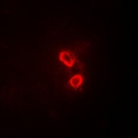 Anti-SYK Antibody