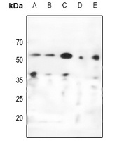 CHK1 Rabbit Polyclonal Antibody