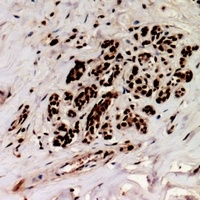 CHK1 Rabbit Polyclonal Antibody