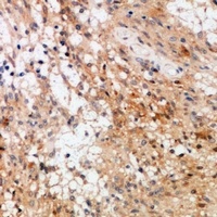 c-RAF Antibody