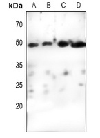 Cyclin E1 Rabbit Polyclonal Antibody