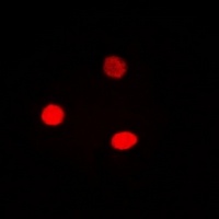 Anti-Cyclin E1 Antibody
