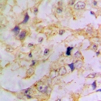 Anti-Doublecortin Antibody
