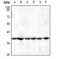 AMPK beta 1 Antibody