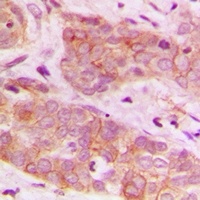 AMPK beta 1 Antibody