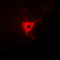 Anti-CDC25B Antibody