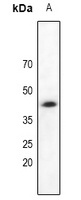 DAP Kinase 2 Rabbit Polyclonal Antibody