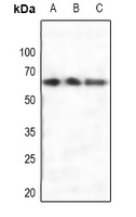 Estrogen Receptor alpha Rabbit Polyclonal Antibody