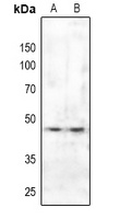 SMAD3 Rabbit Polyclonal Antibody