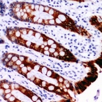 SMAD3 Rabbit Polyclonal Antibody