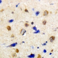 Anti-MKK4 Antibody
