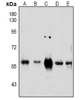 PINK1 Rabbit Polyclonal Antibody