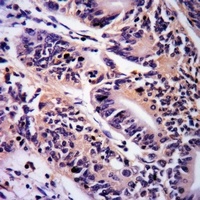 PINK1 Rabbit Polyclonal Antibody