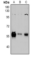 PINK1 Rabbit Polyclonal Antibody