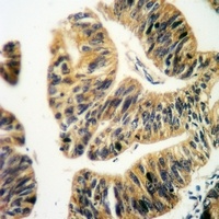 PINK1 Rabbit Polyclonal Antibody