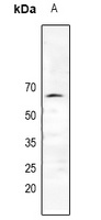 Estrogen Receptor alpha Rabbit Polyclonal Antibody