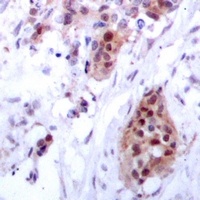 Estrogen Receptor alpha Rabbit Polyclonal Antibody