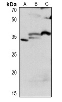 CDC2 Rabbit Polyclonal Antibody