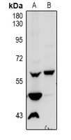Vimentin Rabbit Polyclonal Antibody