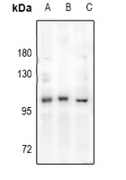 Androgen Receptor Rabbit Polyclonal Antibody