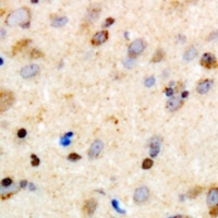 Anti-Girdin Antibody