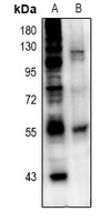 ETS1 Rabbit Polyclonal Antibody