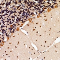 Anti-TSG101 Antibody
