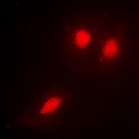 Anti-TSG101 Antibody