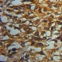 Anti-MYO10 Antibody