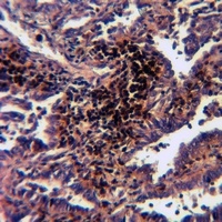 Anti-VRK3 Antibody
