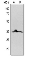 CD20 Rabbit Polyclonal Antibody