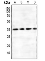 FKSG1 Rabbit Polyclonal Antibody