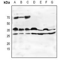 Oligo2 Rabbit Polyclonal Antibody
