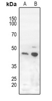 ROR gamma Rabbit Polyclonal Antibody