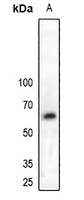 MPP6 Rabbit Polyclonal Antibody