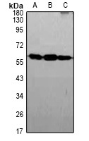 GLUT2 Rabbit Polyclonal Antibody