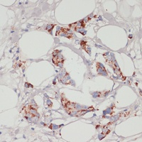 Anti-ACSL3 Antibody
