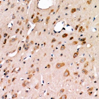 Anti-IRE1 Antibody