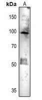 ACO1 Antibody