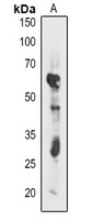 atpB Rabbit Polyclonal Antibody